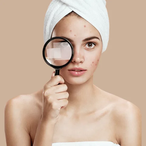 Skin Concern - Acne & Dark Spots