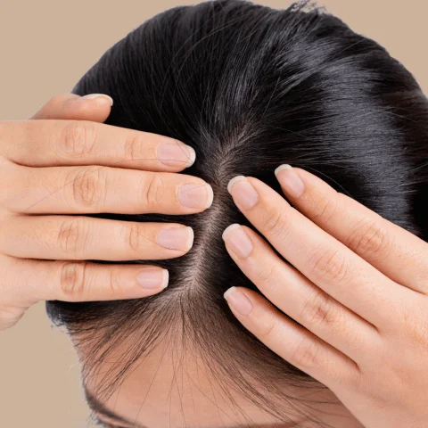 Hair Concern - Scalp Care