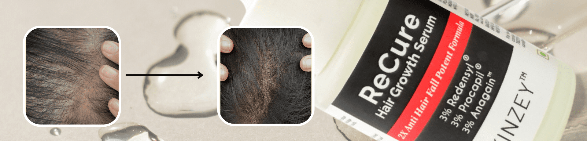 12 week hair regrowth serum