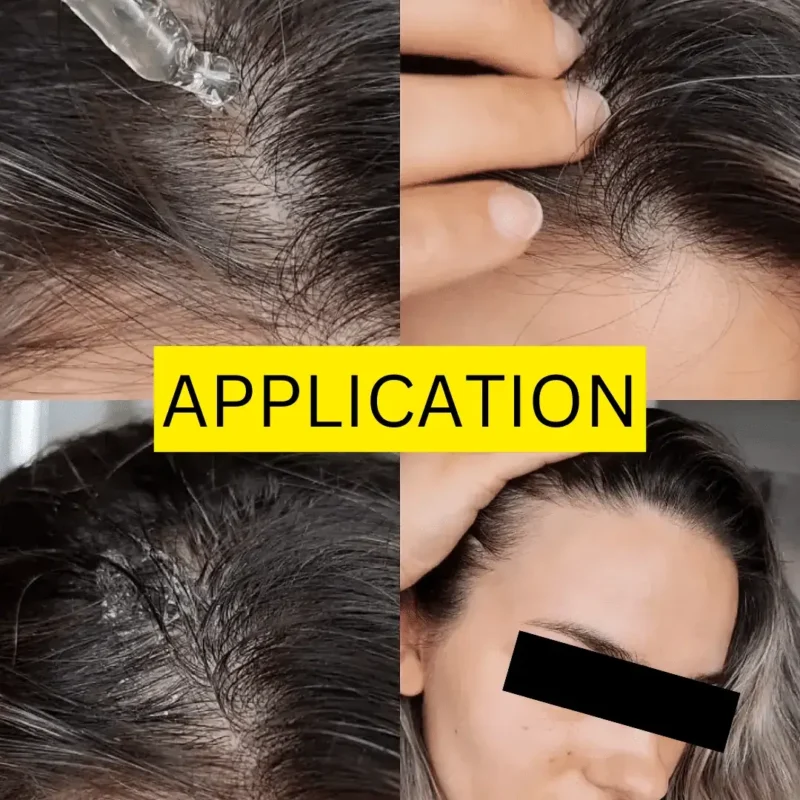 recure hair regrowth serum before after