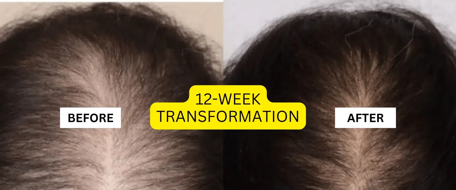 recure 12 week transformation