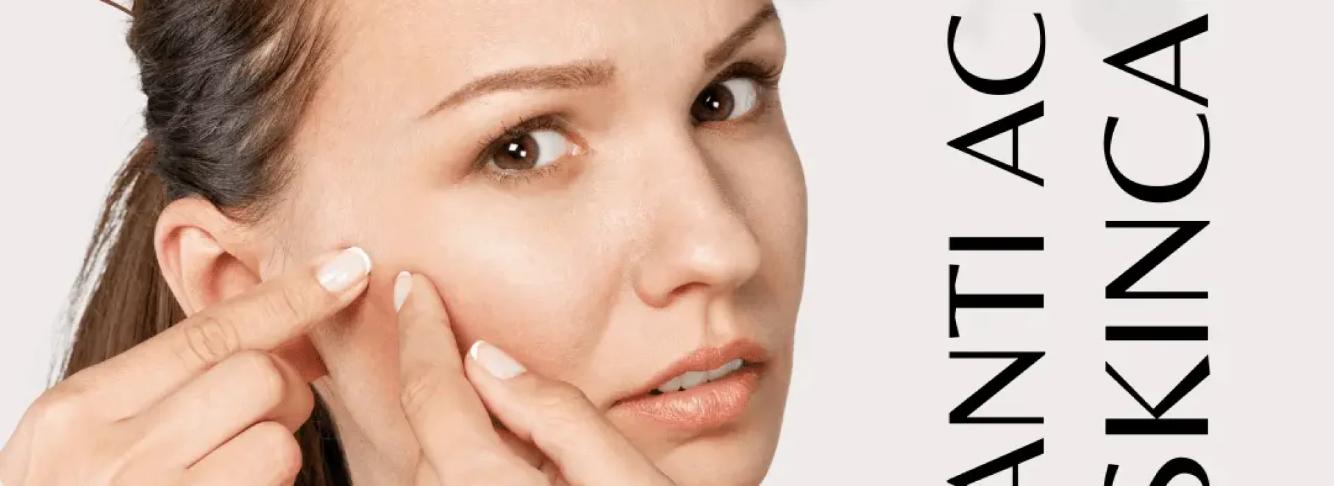 Acne - Causes and Types